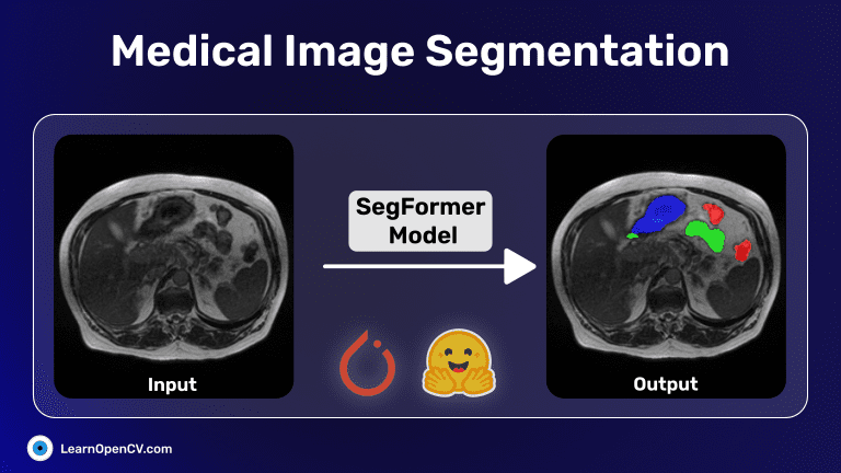 Medical Image Segmentation Platform